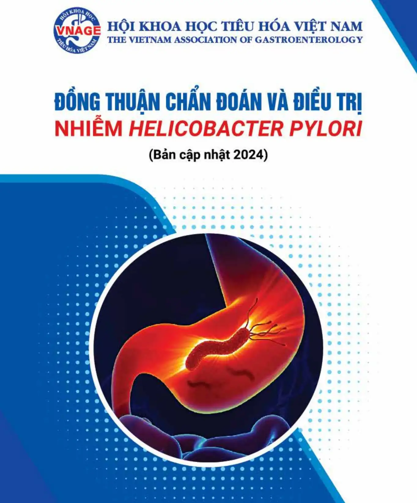 Đồng thuận chẩn đoán và điều trị nhiễm Helicobacter Pylori
